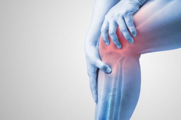 knee pain xray